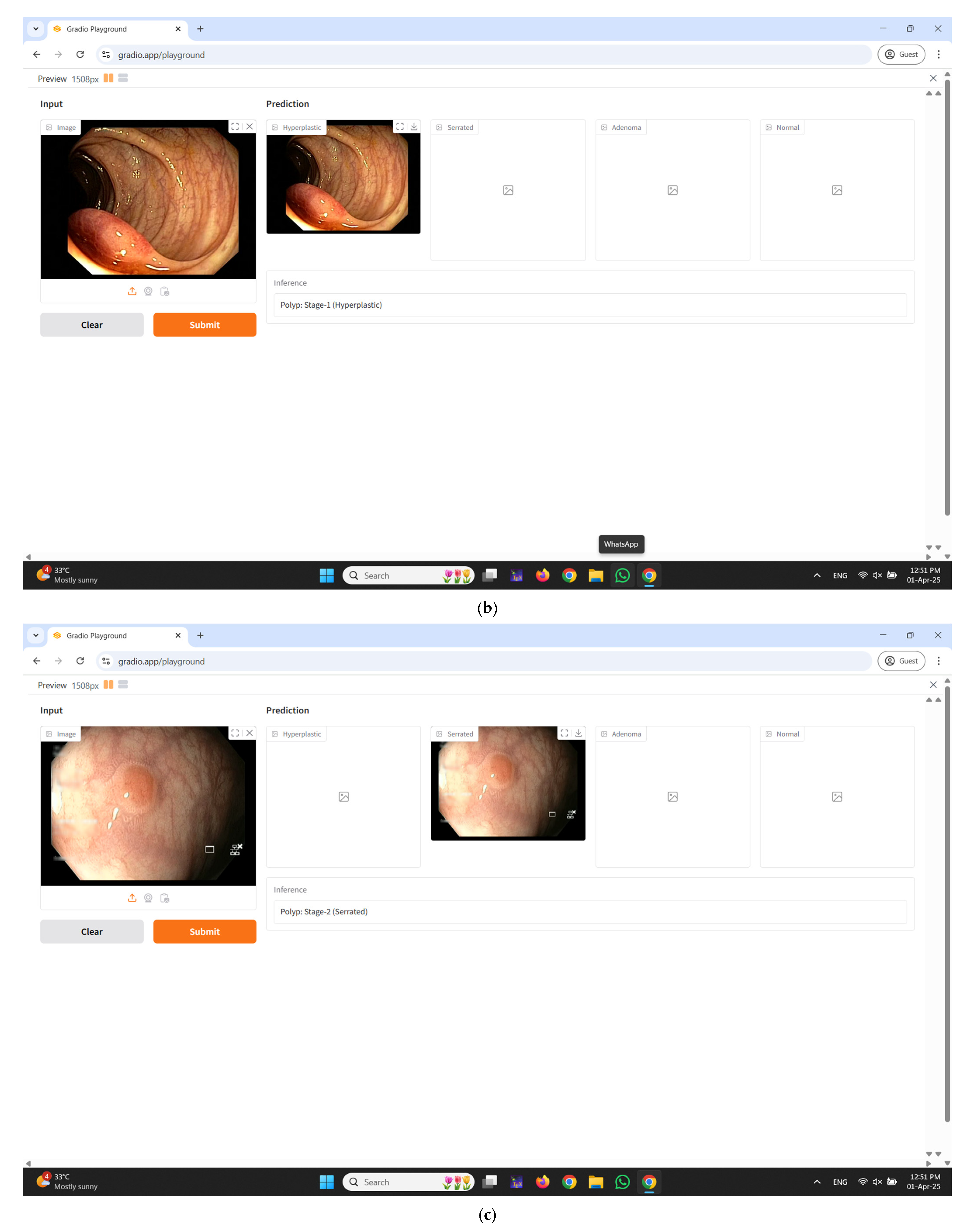 Diagnostics 15 01285 g011b Diagnostics 15 01285 g011b