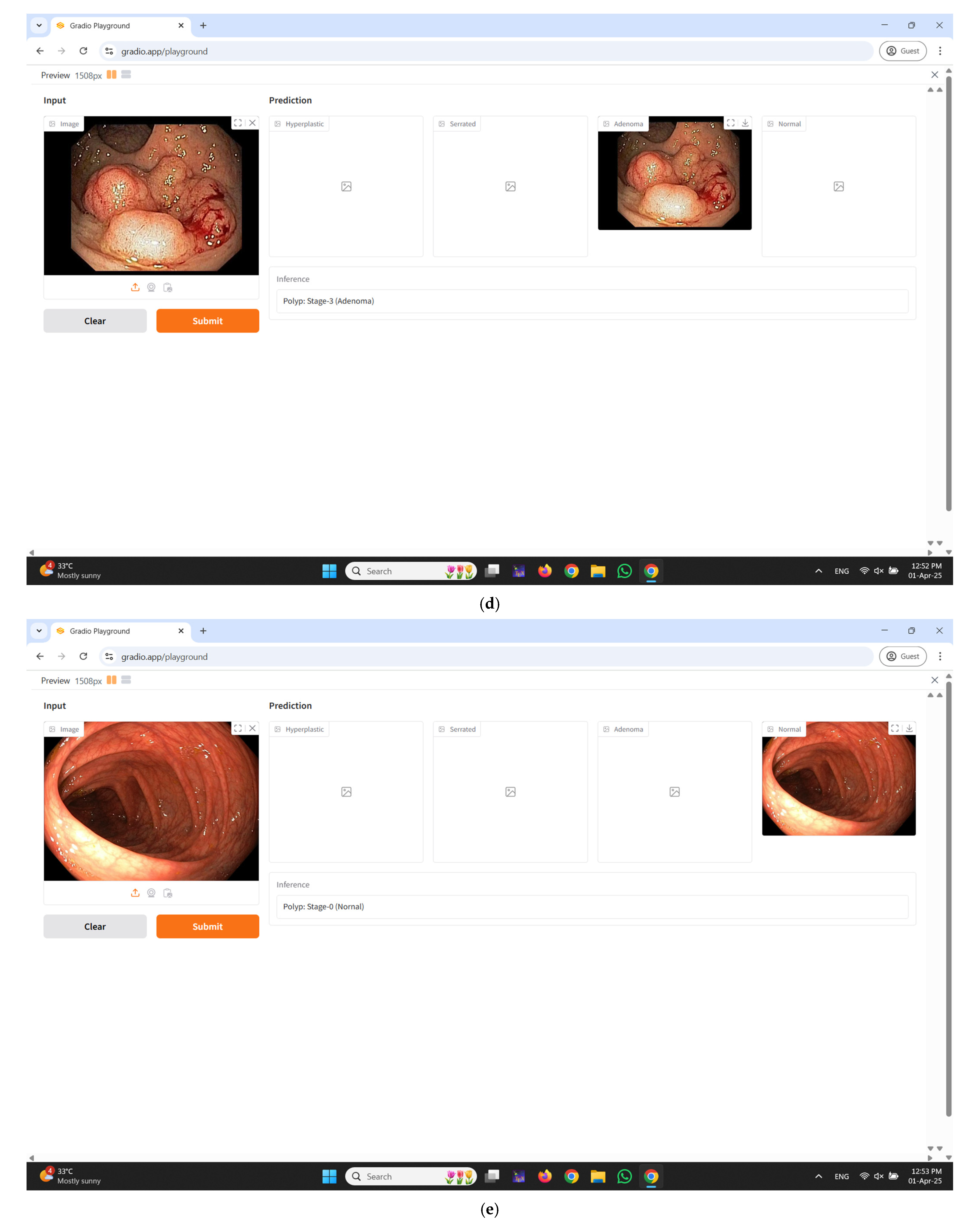 Diagnostics 15 01285 g011c Diagnostics 15 01285 g011c