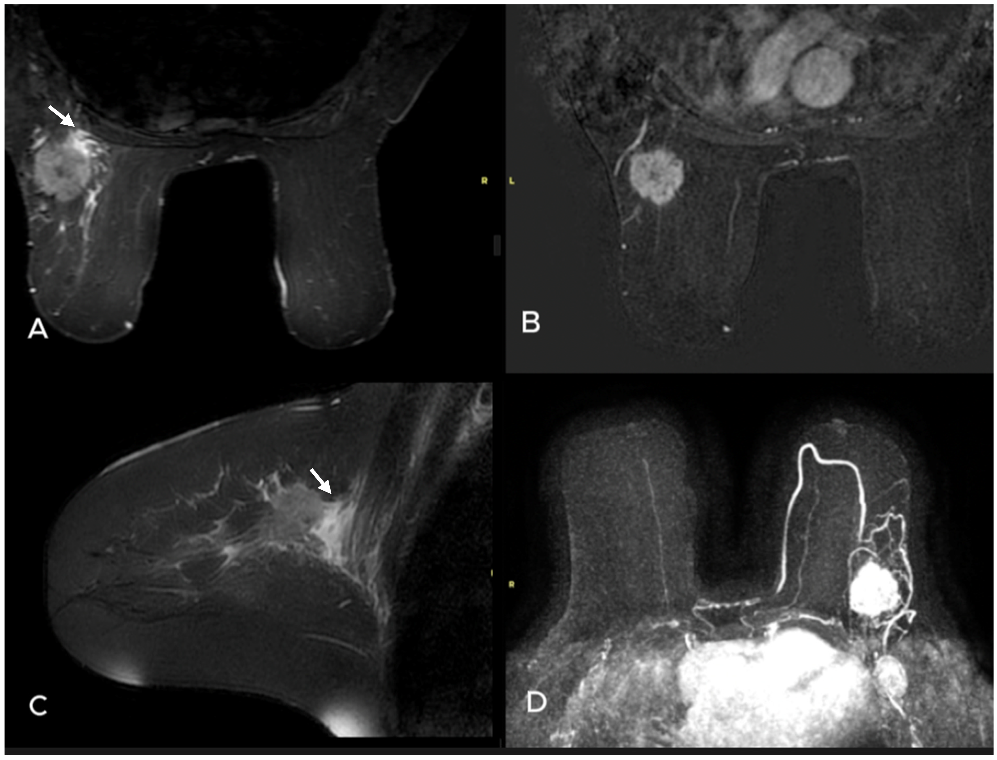 Diagnostics 15 01300 g003