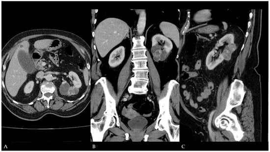 Diagnostics 15 01326 g001
