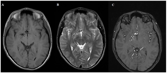 Diagnostics 15 01333 g001