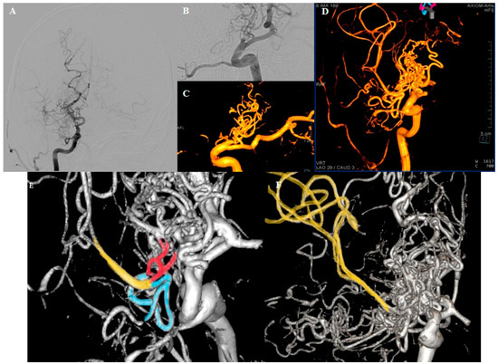 Diagnostics 15 01333 g002