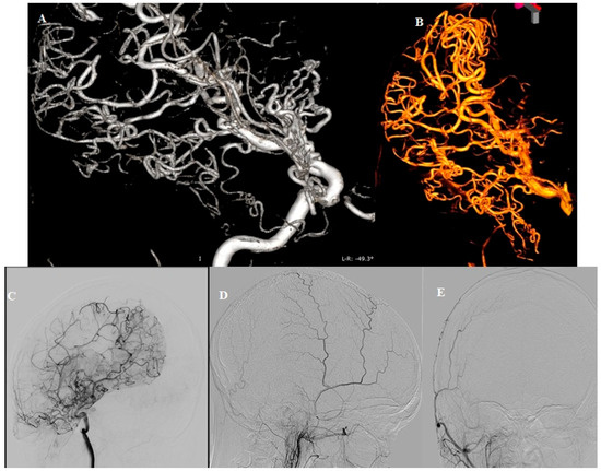 Diagnostics 15 01333 g003