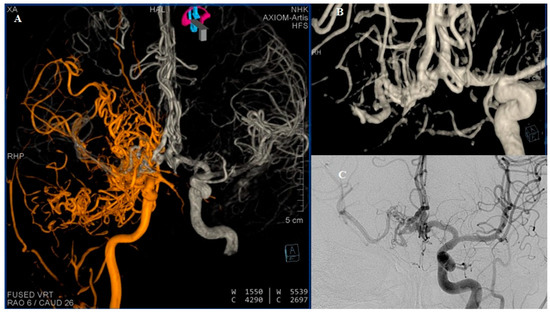 Diagnostics 15 01333 g004