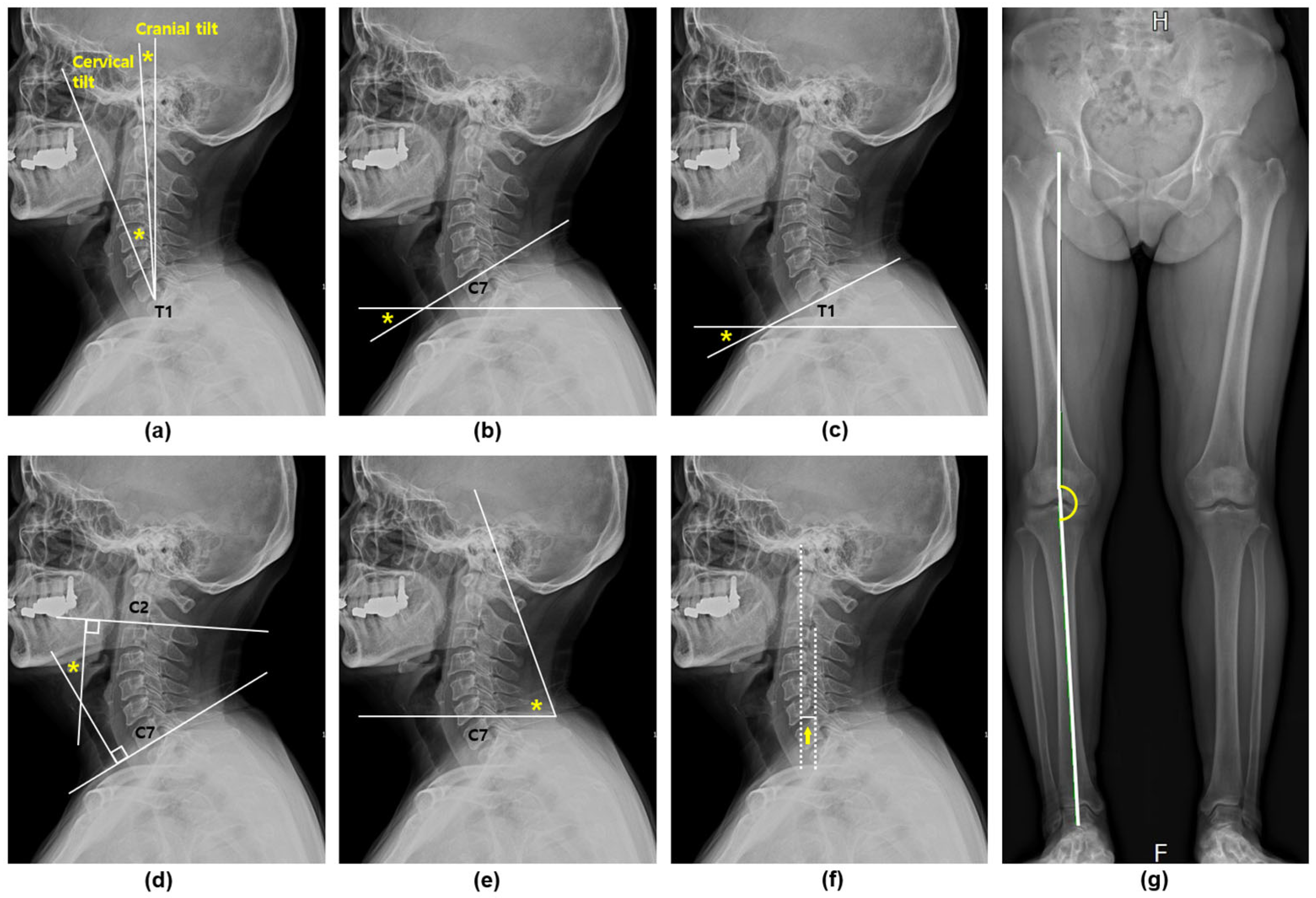 Diagnostics 15 01340 g002 Diagnostics 15 01340 g002