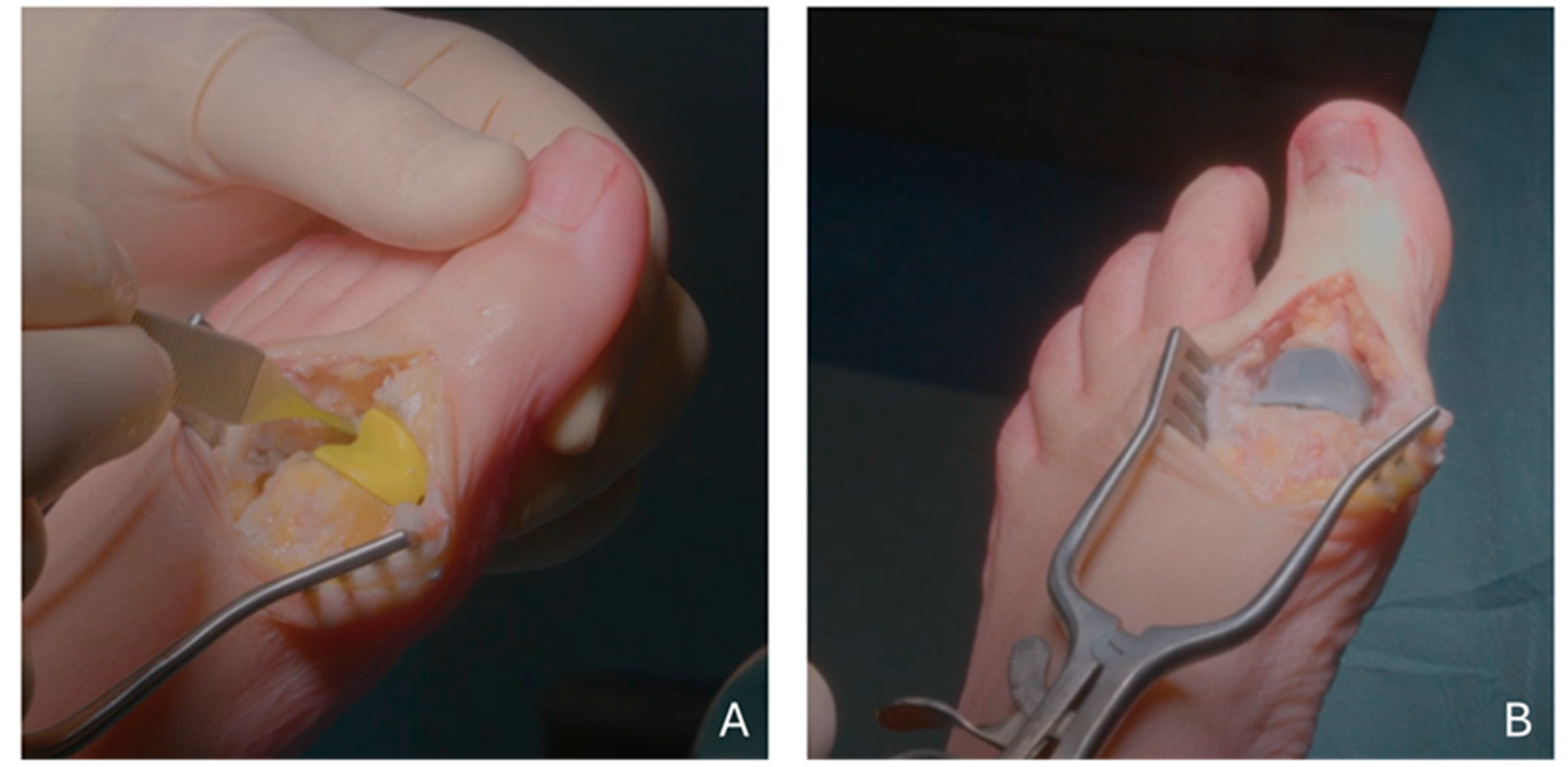 Diagnostics 15 01349 g001