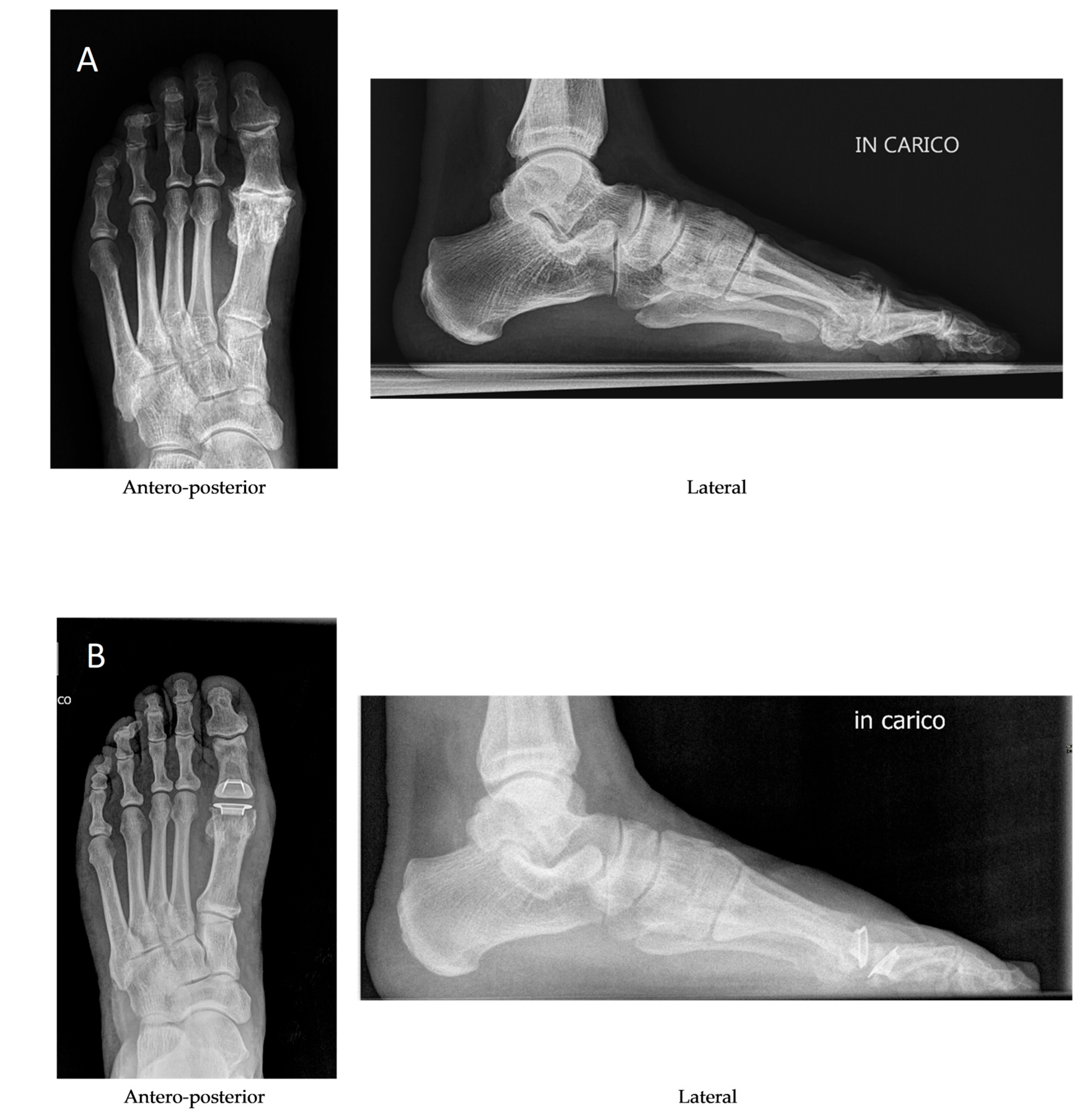 Diagnostics 15 01349 g004