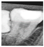 Diagnostics 15 01363 i001