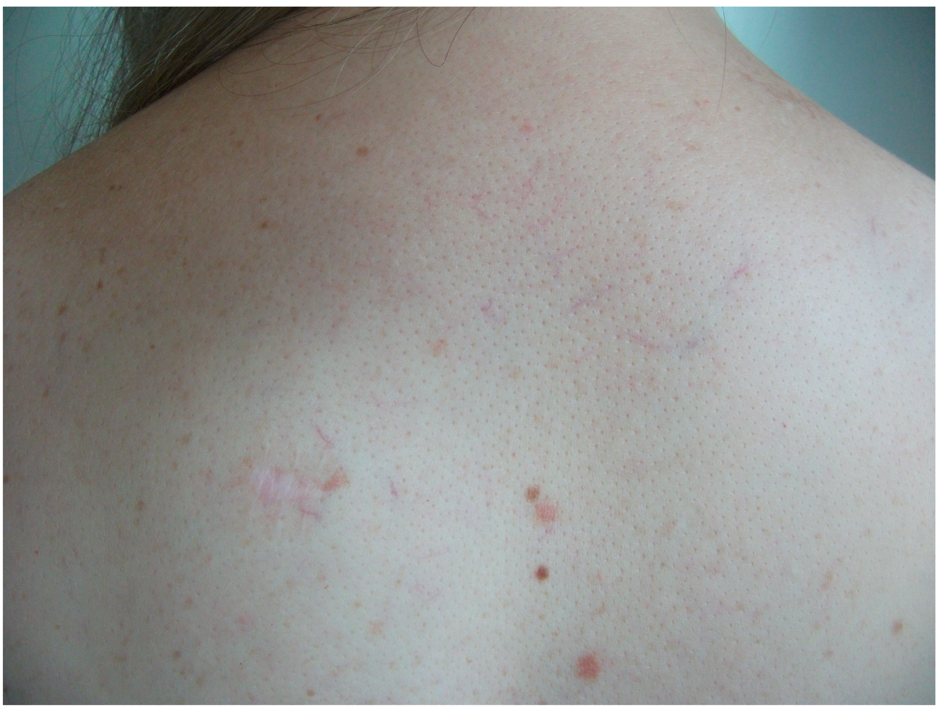 Diagnostics 15 01370 g005