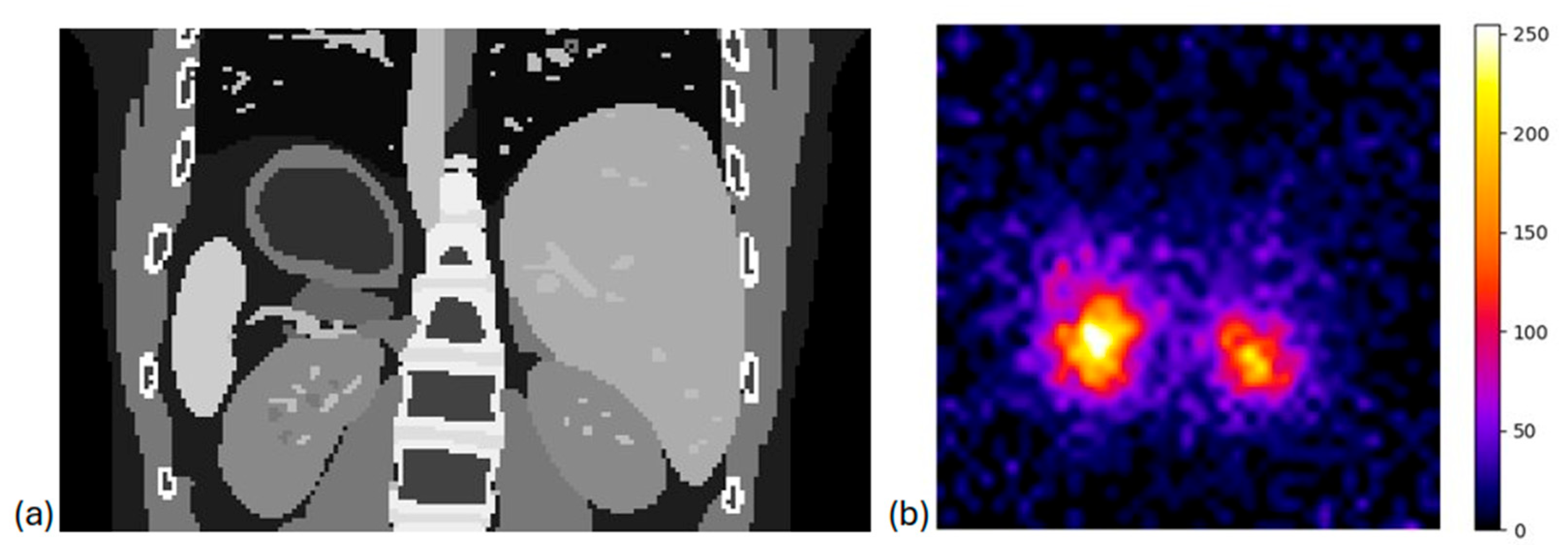 Diagnostics 15 01387 g011