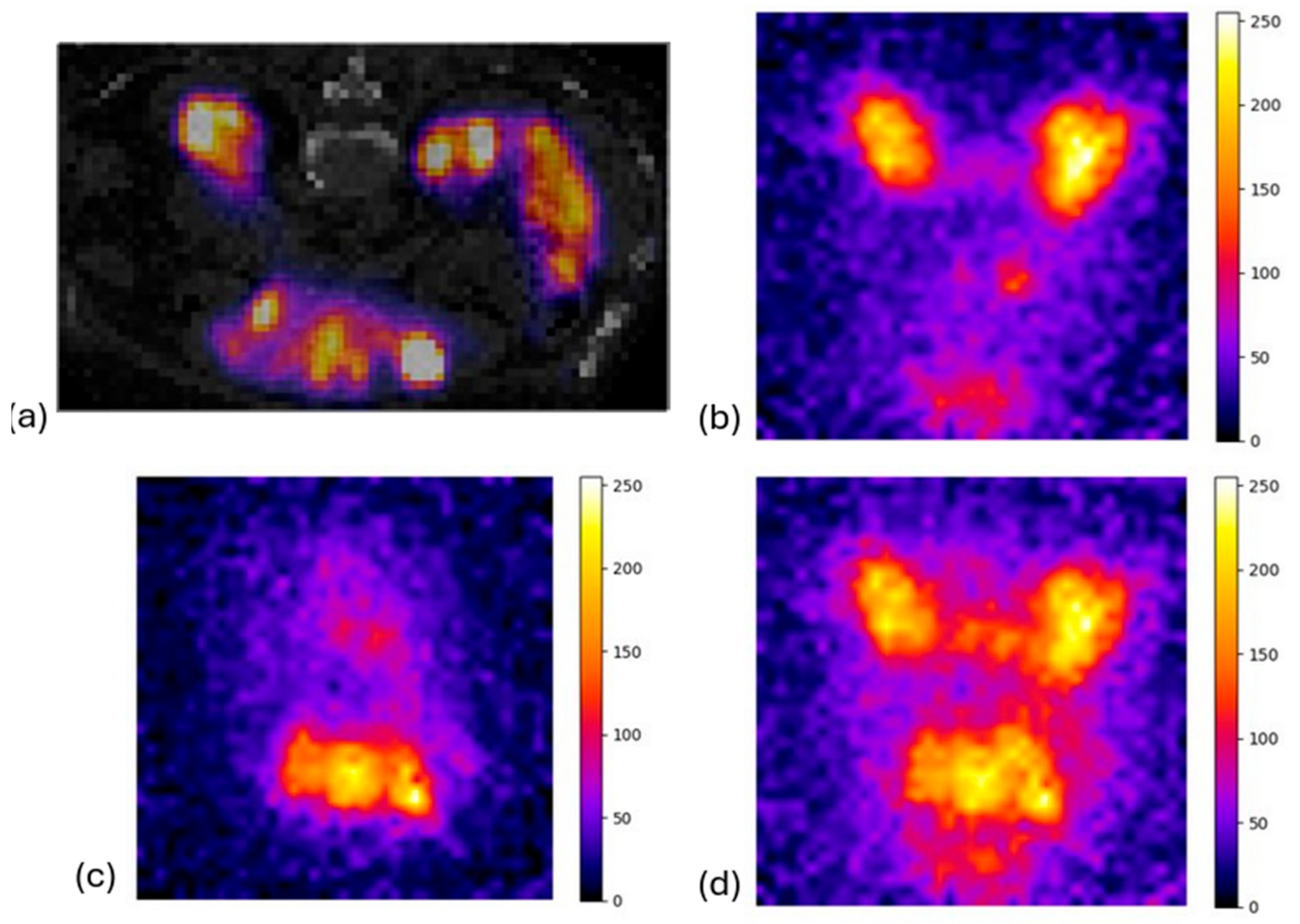 Diagnostics 15 01387 g012