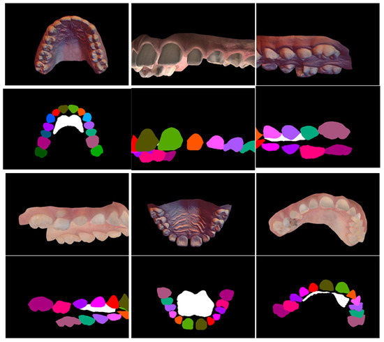 Diagnostics 15 01415 g0a1