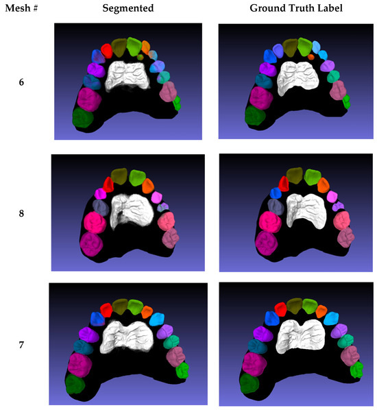 Diagnostics 15 01415 g0a3