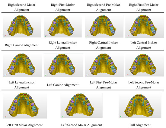 Diagnostics 15 01415 g0a4b