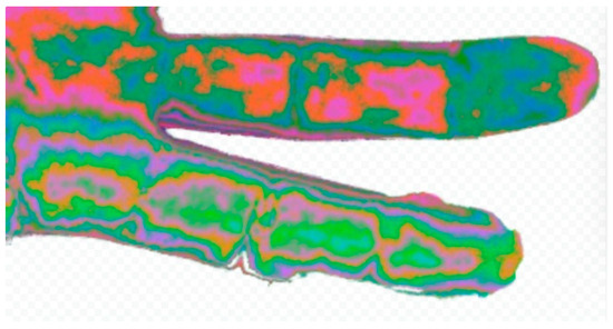 Diagnostics 15 01417 g005