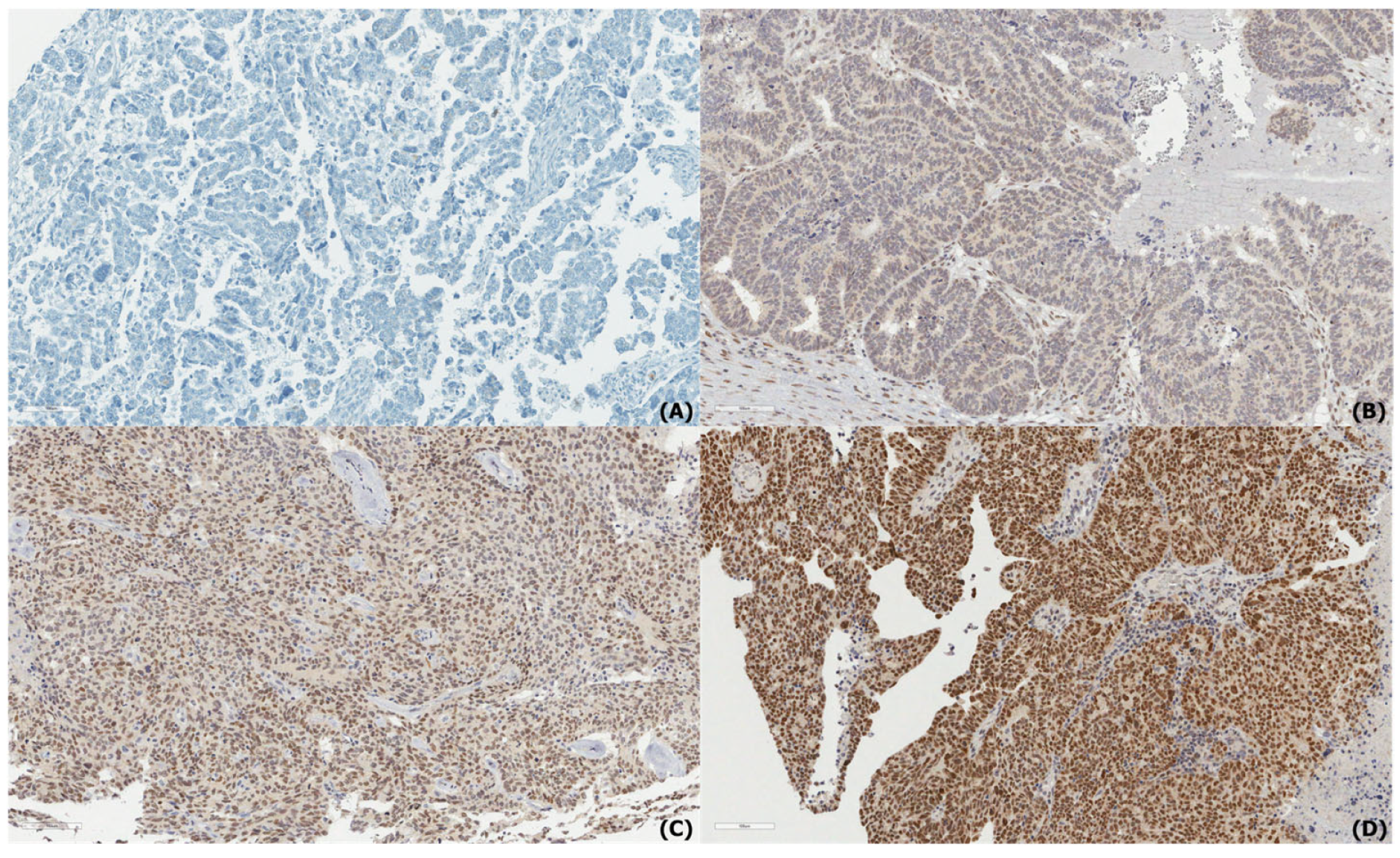 Diagnostics 15 01426 g001