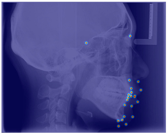 Diagnostics 15 01468 g0a2