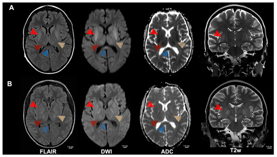 Diagnostics 15 01470 g001