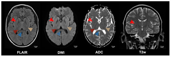 Diagnostics 15 01470 g002