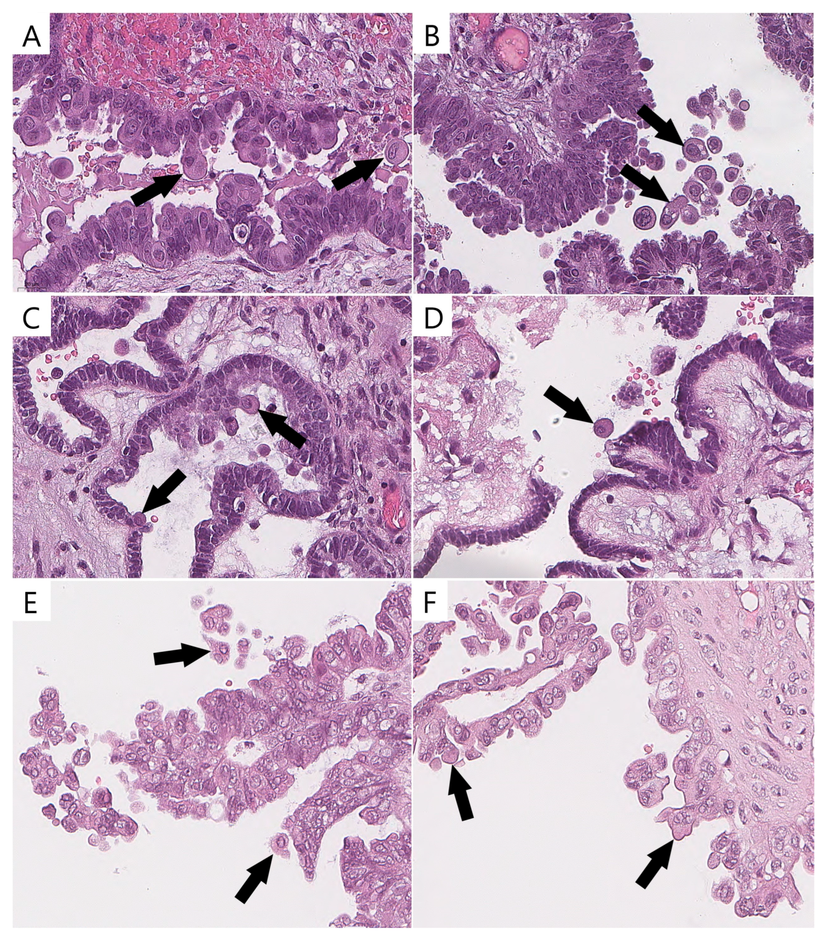Diagnostics 15 01479 g003