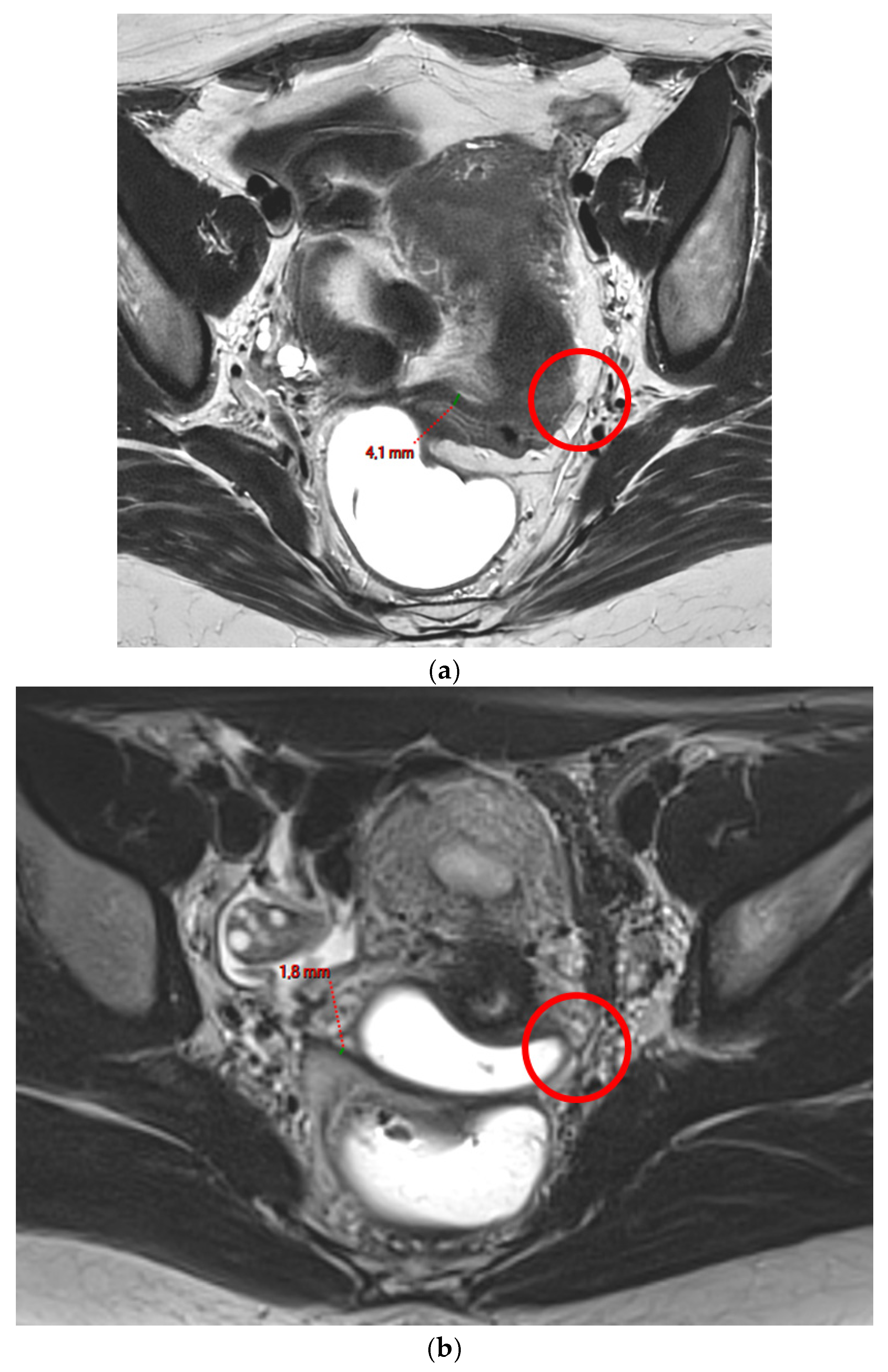 Diagnostics 15 01508 g001