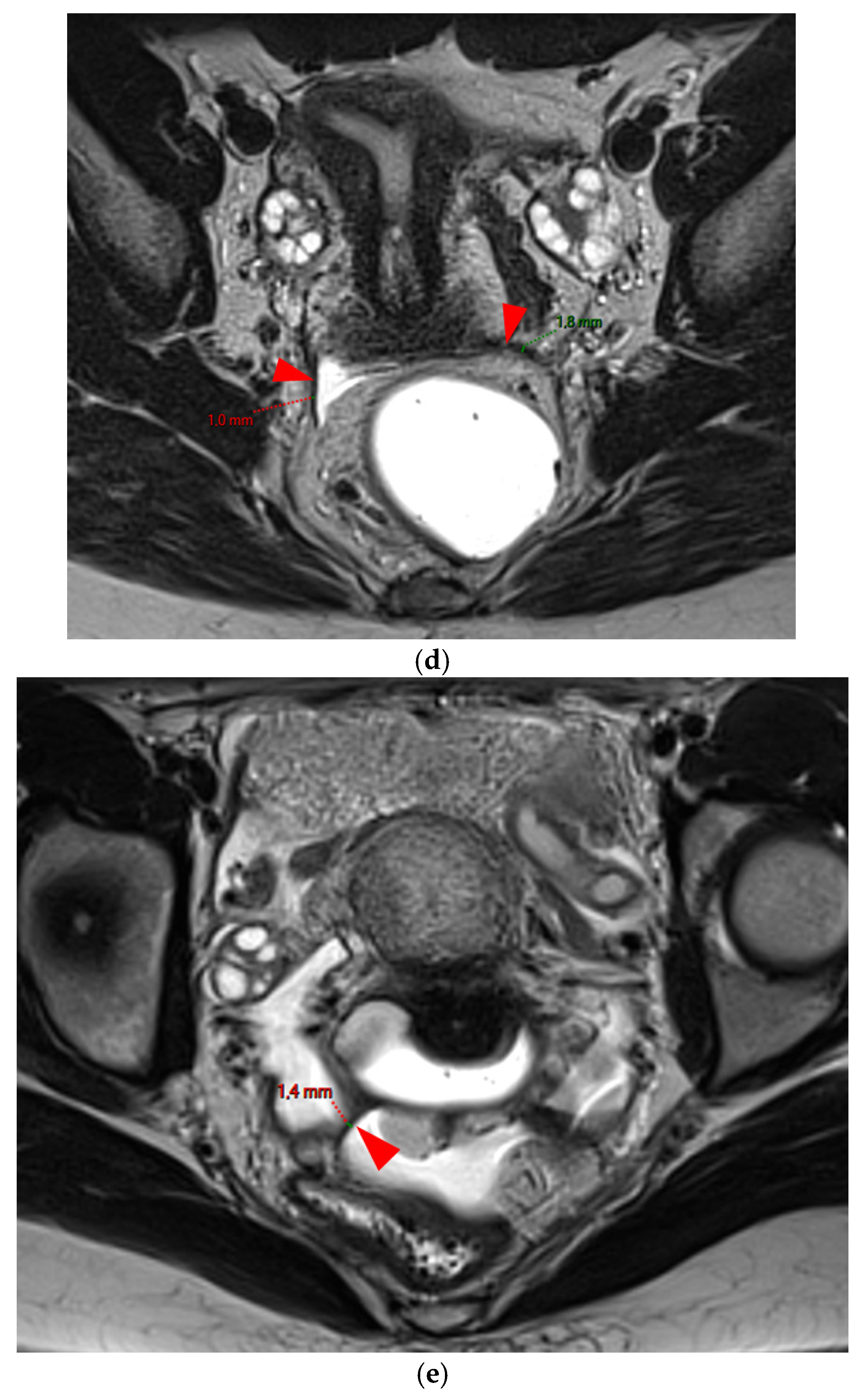 Diagnostics 15 01508 g002b
