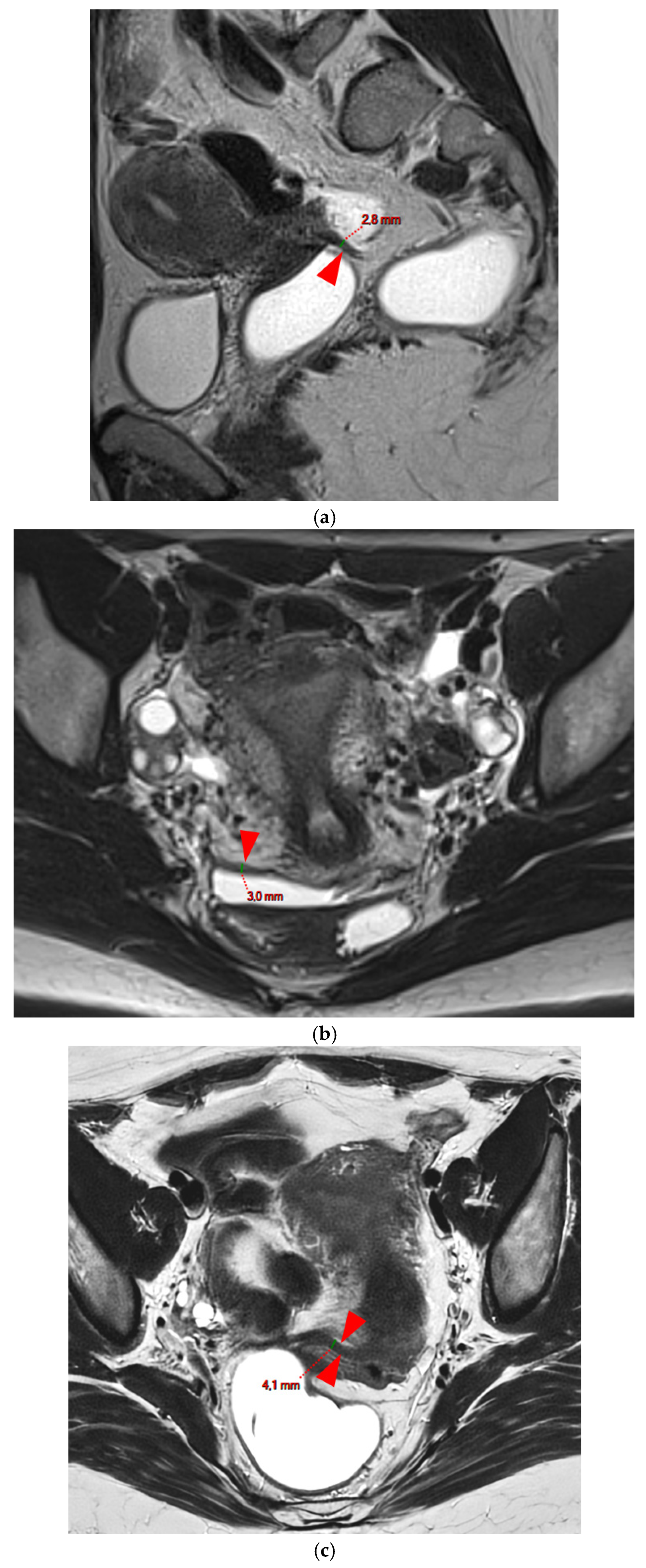 Diagnostics 15 01508 g003