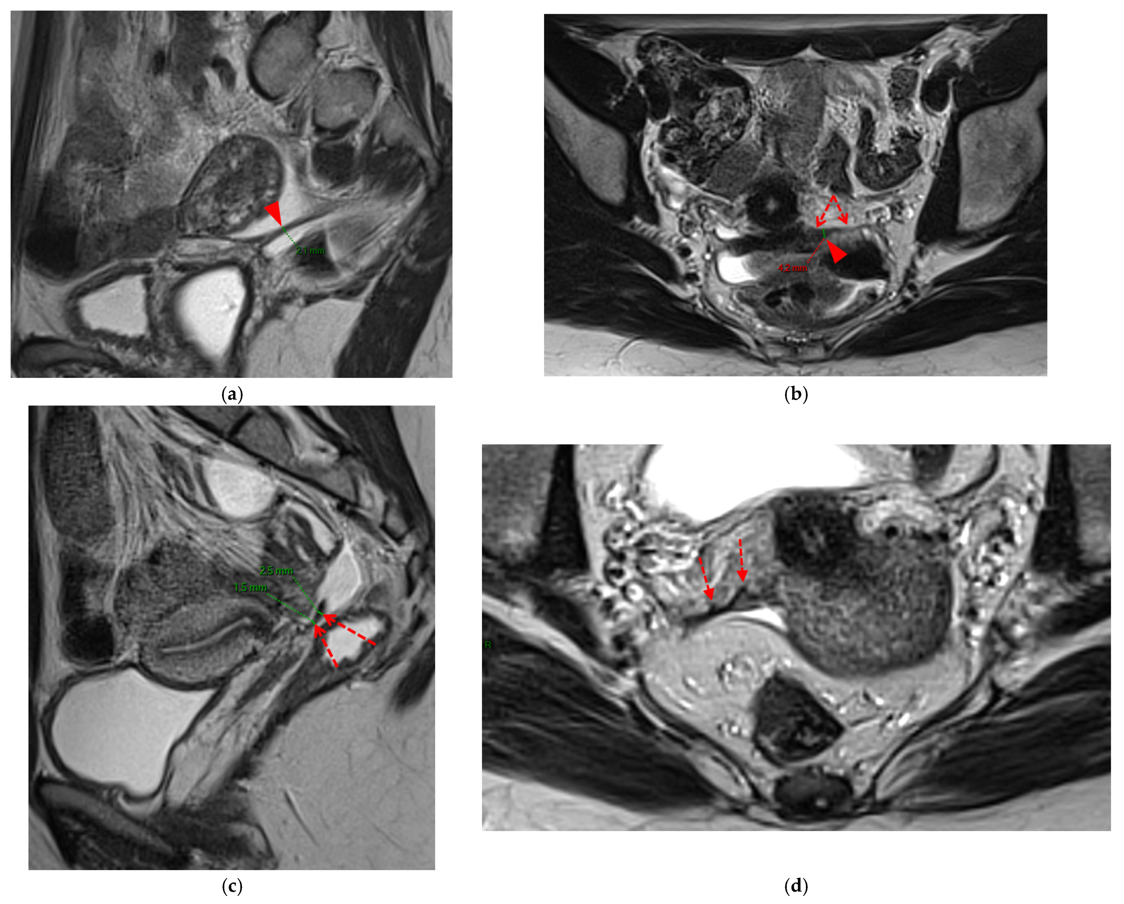 Diagnostics 15 01508 g004a