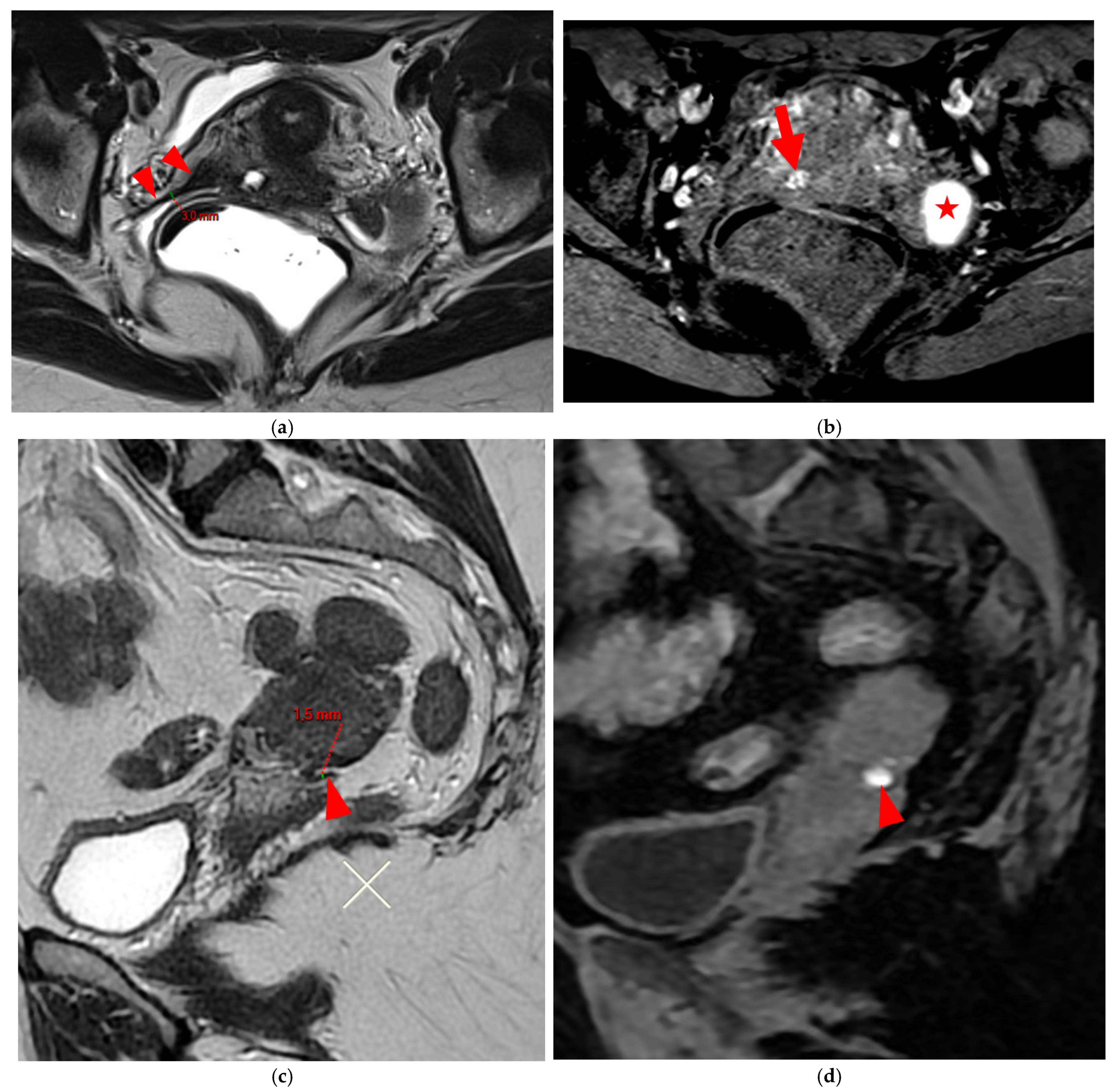 Diagnostics 15 01508 g005