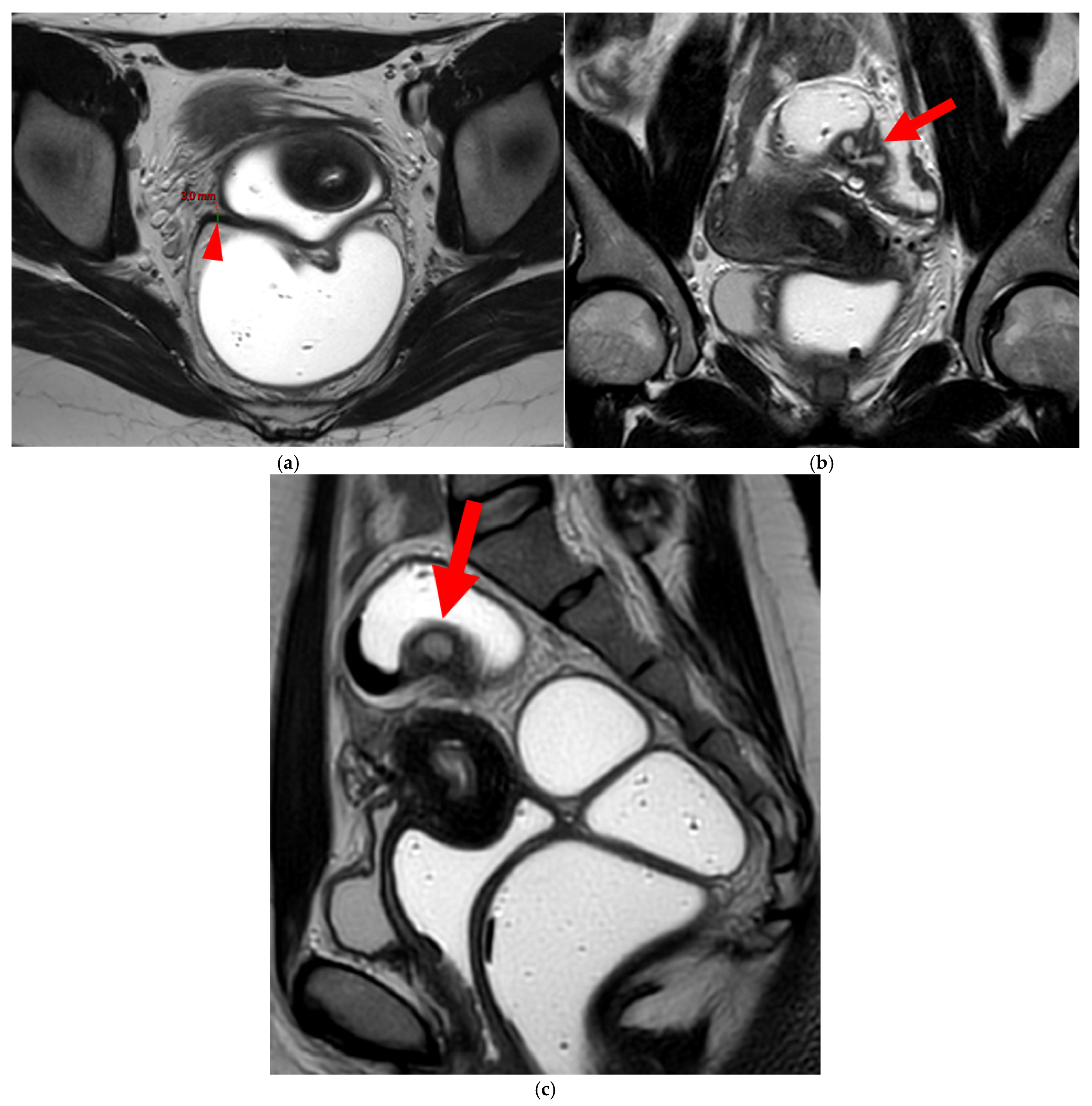 Diagnostics 15 01508 g008