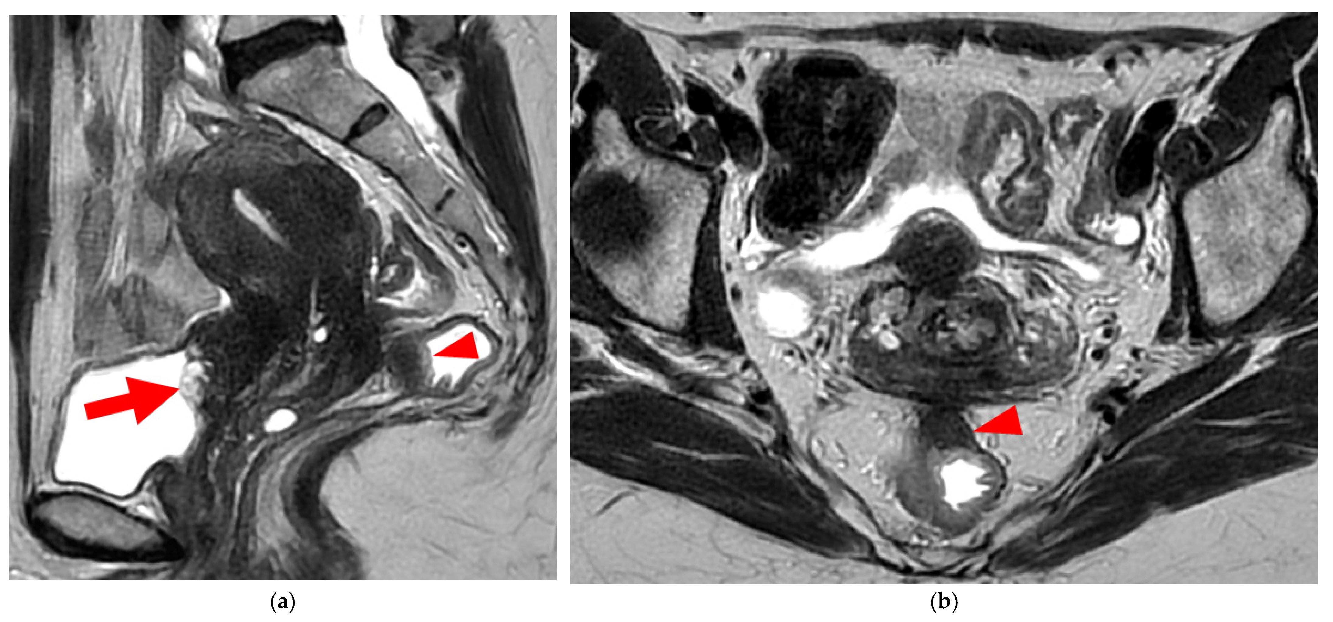 Diagnostics 15 01508 g009a