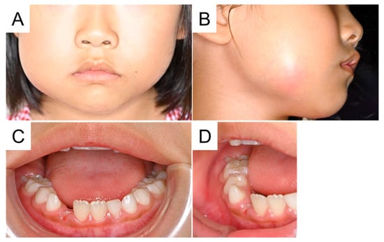 Diagnostics 15 01531 g001