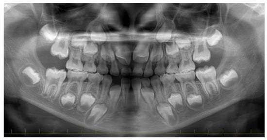 Diagnostics 15 01531 g002