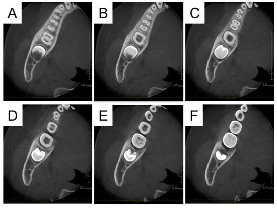 Diagnostics 15 01531 g007