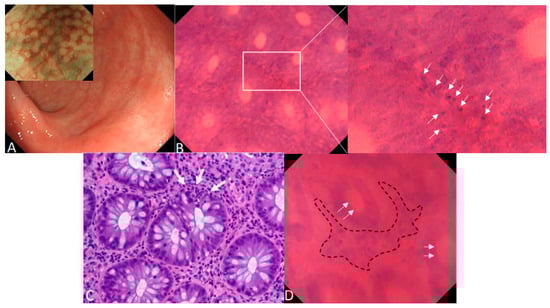 Diagnostics 15 01595 g001