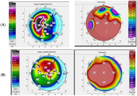 Diagnostics 15 01596 g003
