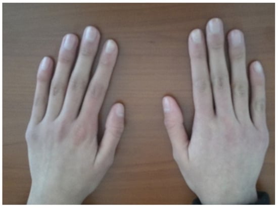 Diagnostics 15 01596 g004