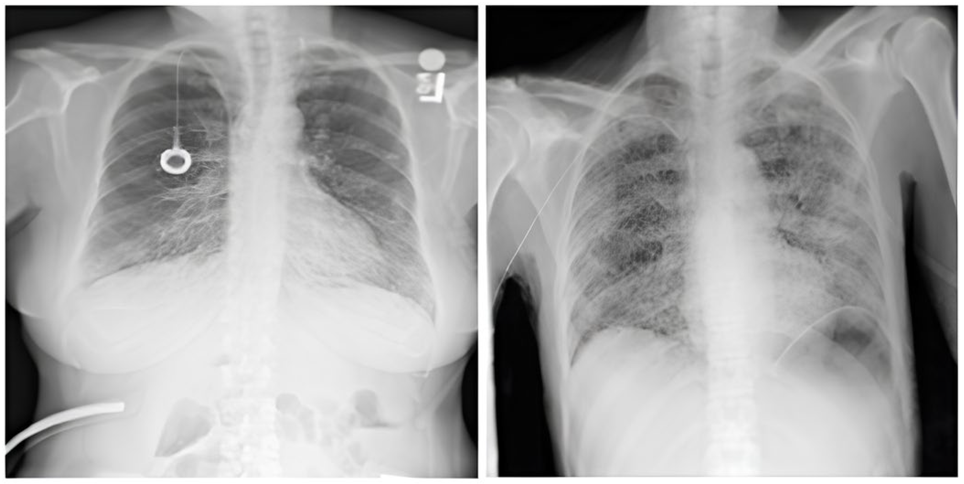 Diagnostics 15 01602 g003