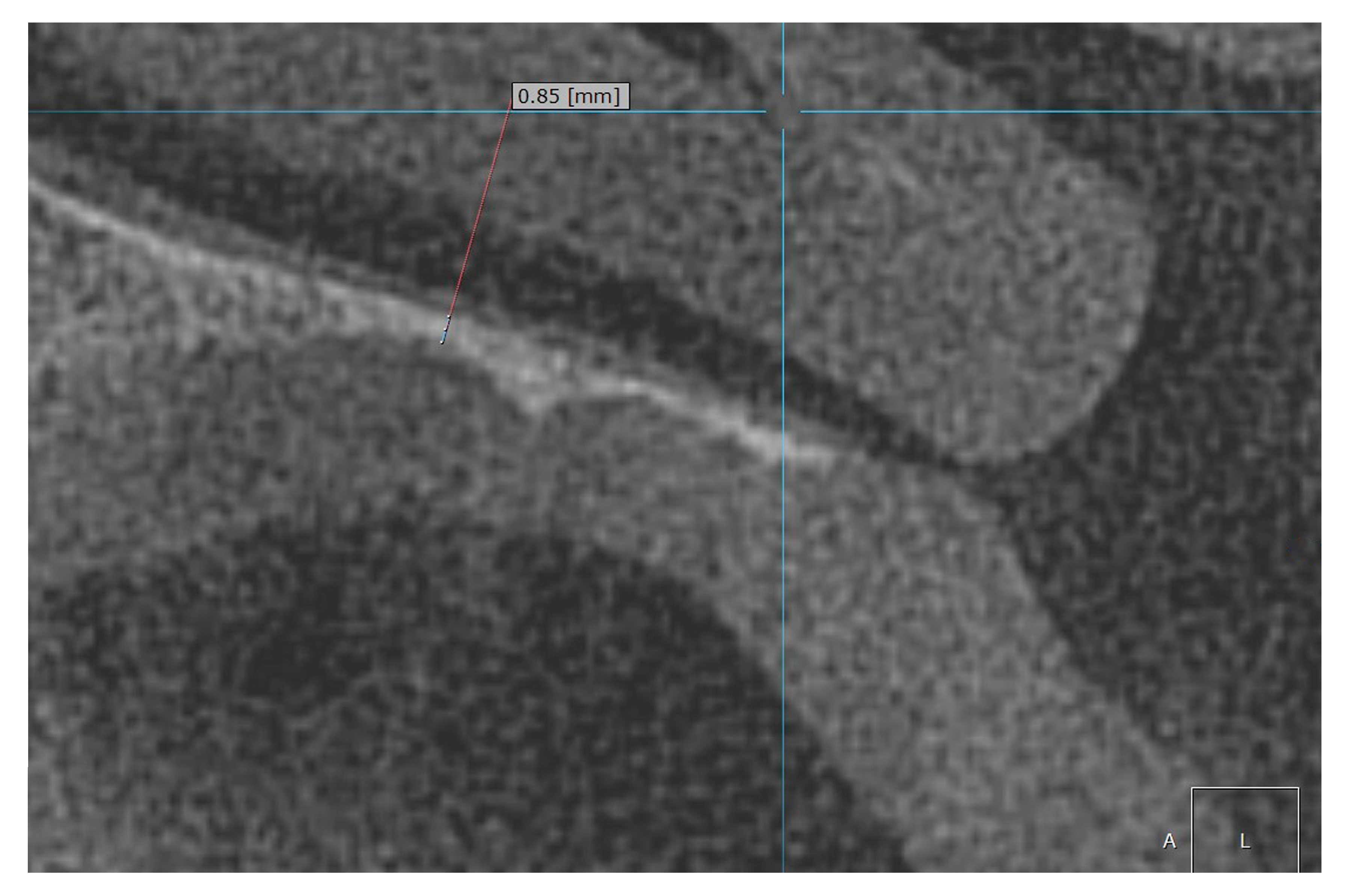 Diagnostics 15 01603 g003 Diagnostics 15 01603 g003