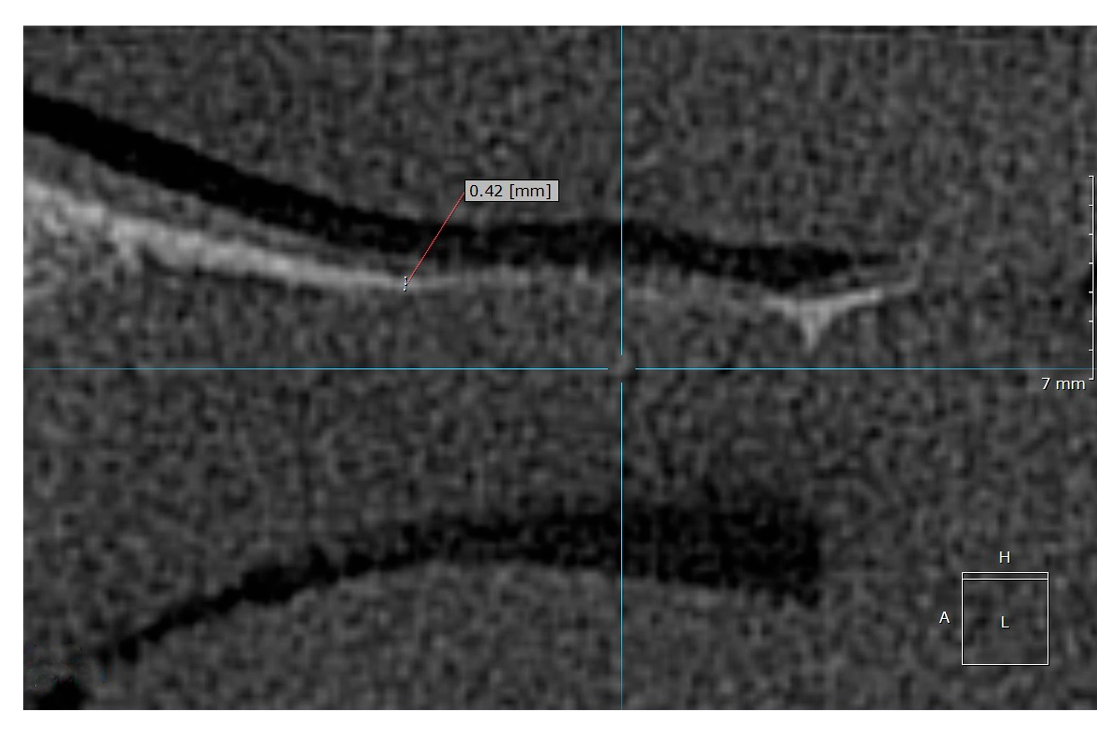 Diagnostics 15 01603 g004 Diagnostics 15 01603 g004