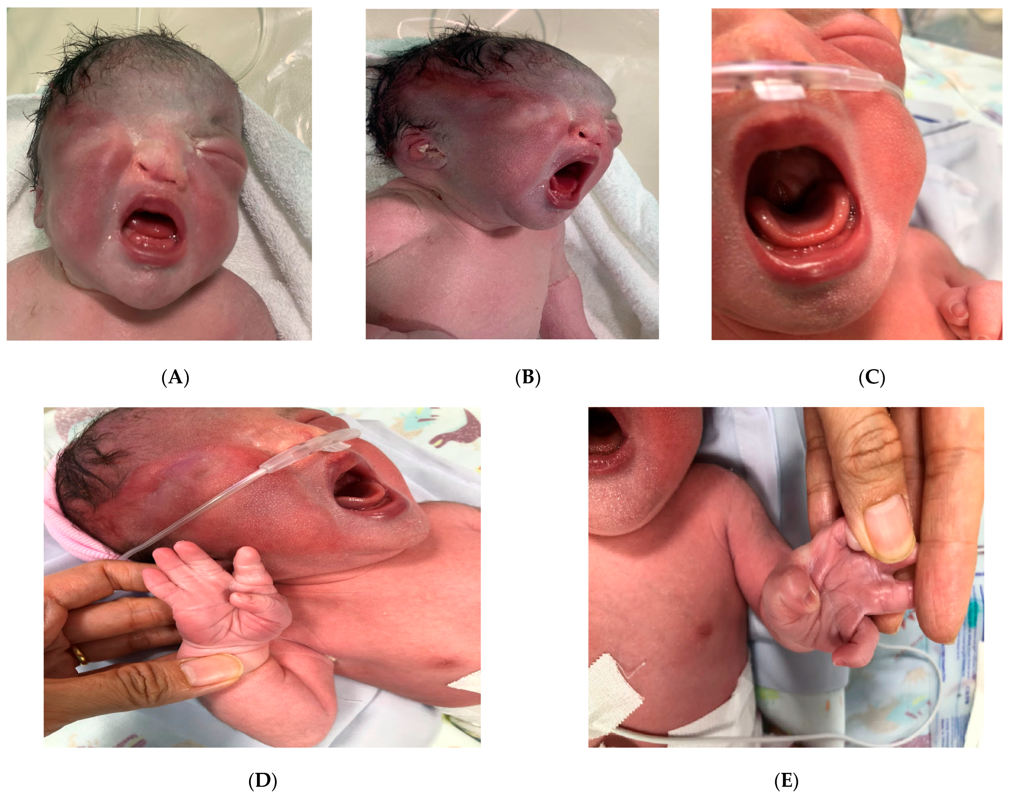 Diagnostics 15 01606 g001a