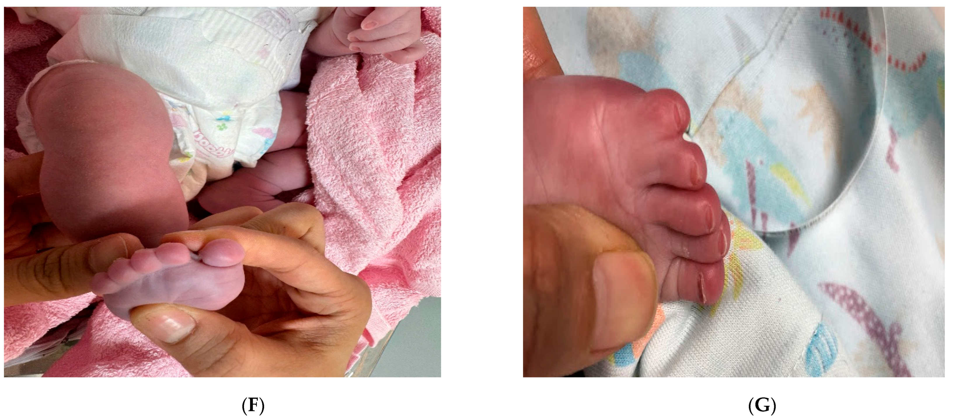 Diagnostics 15 01606 g001b