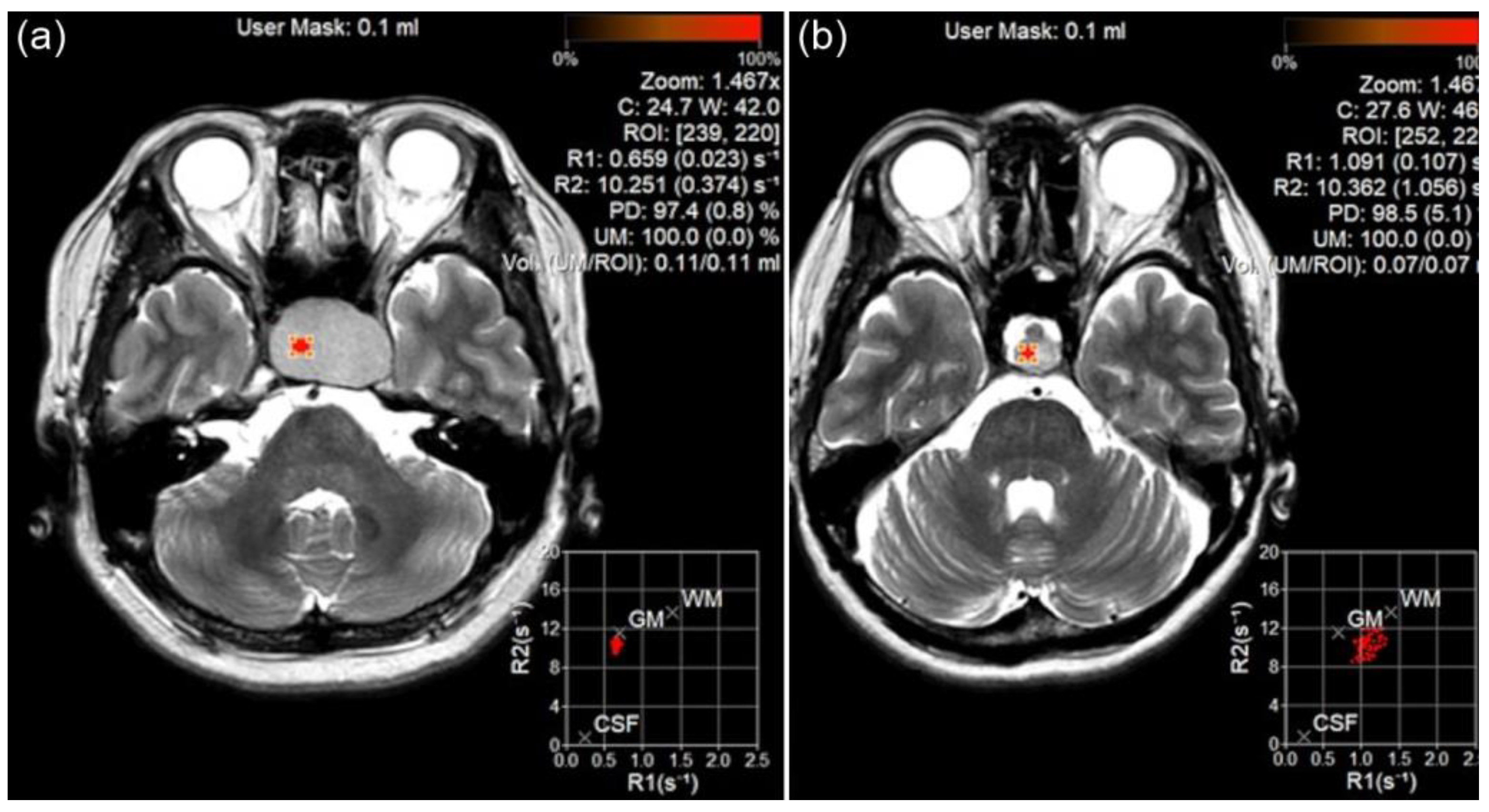 Diagnostics 15 01607 g001