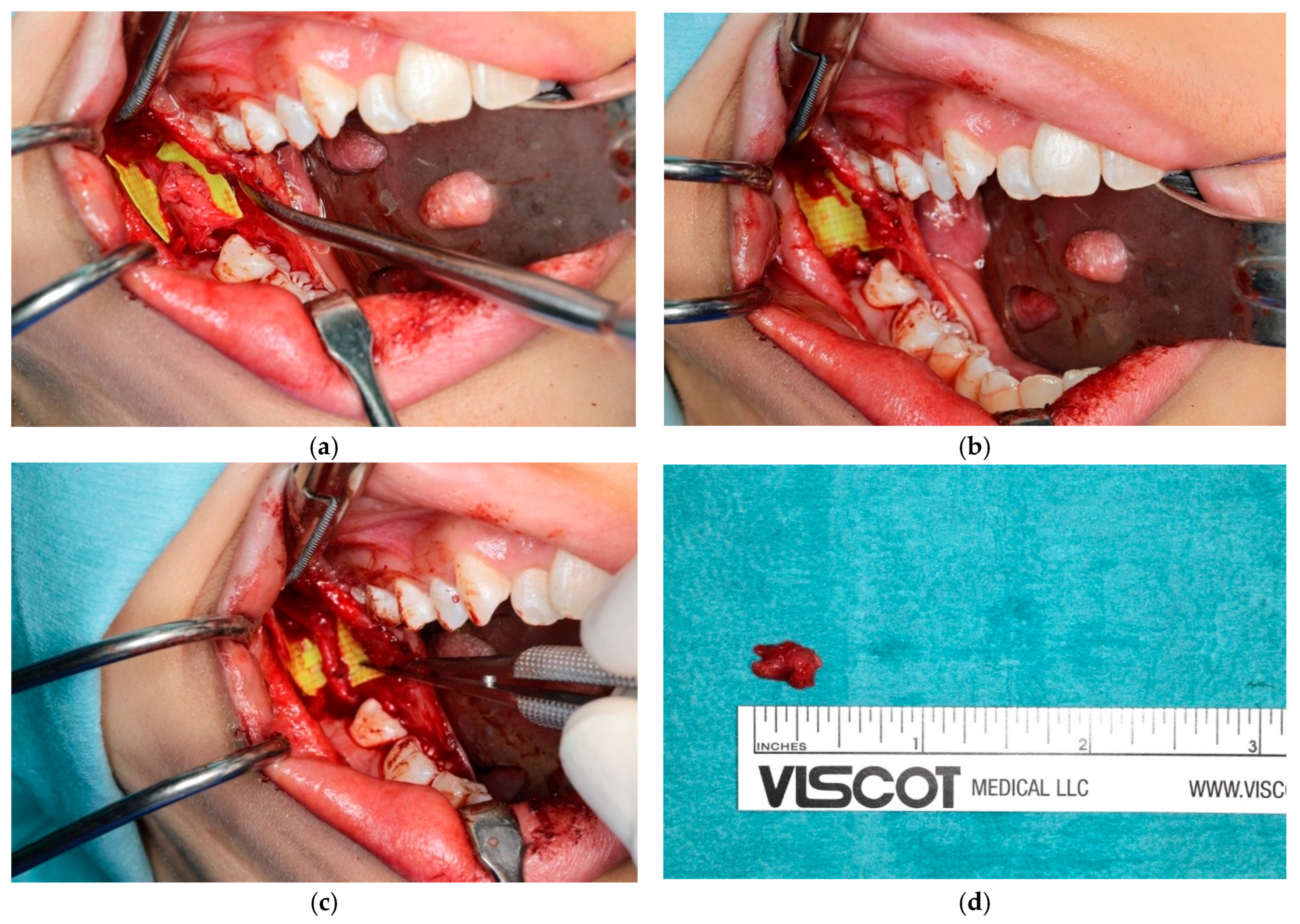 Diagnostics 15 01609 g008