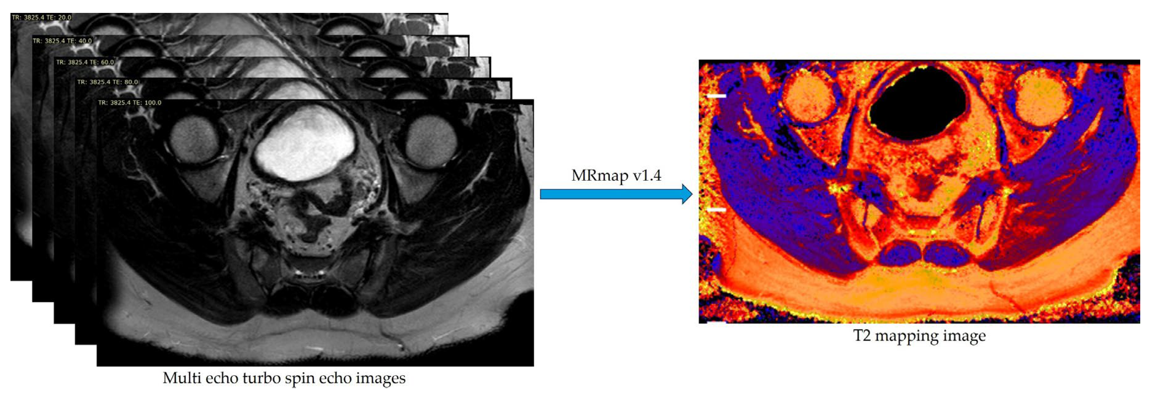 Diagnostics 15 01634 g001