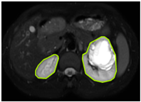 Diagnostics 15 01636 i002