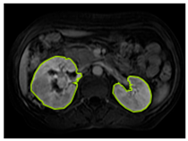 Diagnostics 15 01636 i004