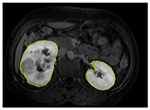 Diagnostics 15 01636 i006