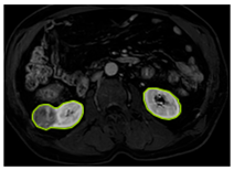Diagnostics 15 01636 i007