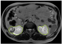 Diagnostics 15 01636 i008
